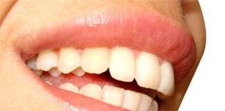 5 Foods for Healthy Teeth