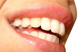 5 Foods for Healthy Teeth
