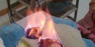 4 Shocking Face Cosmetic Procedures