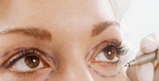 5 Scary Facts about Plastic Surgery