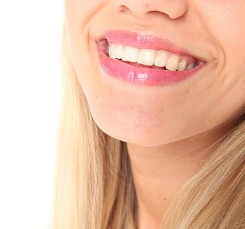 5 Foods for White Teeth
