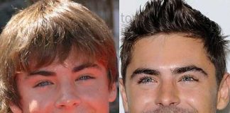 Celebrities' Smiles Before and After Correction