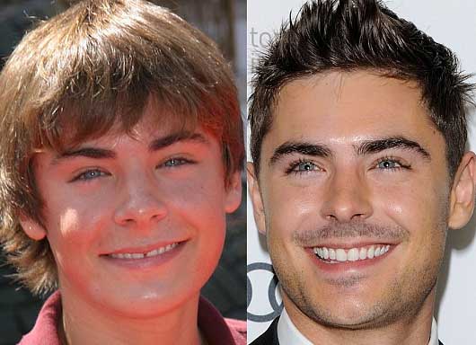 zac-efron