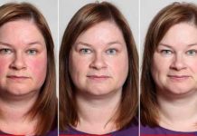 How Does the Face Change After Quitting Drinking?
