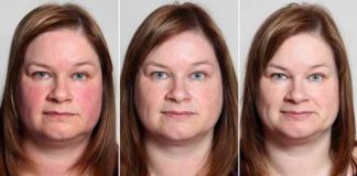 How Does the Face Change After Quitting Drinking?