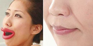 Anti-Wrinkle Gadget Mouthpiece