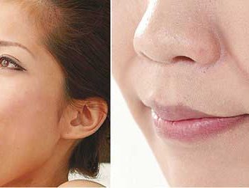 Anti-Wrinkle Gadget Mouthpiece