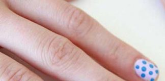 What Are White Spots on Nails?