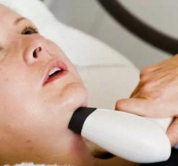 New Gadget to Reduce Double Chin