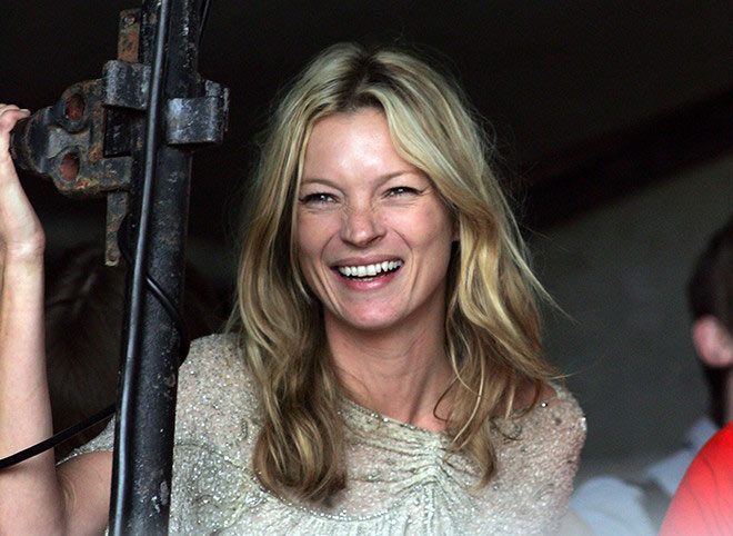 kate moss teeth