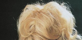 11 Celebrities with Ugly Teeth Part 2