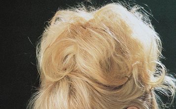 11 Celebrities with Ugly Teeth Part 2