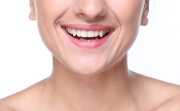 10 Teeth Whitening Mistakes