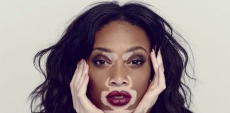 8 Models Who Made a Career against all Odds