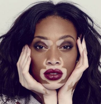 8 Models Who Made a Career against all Odds