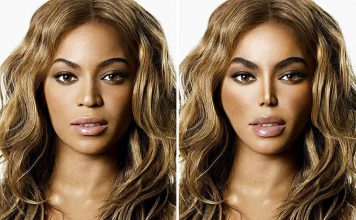 10 Hollywood Celebrities’ Faces Before & After Surgery