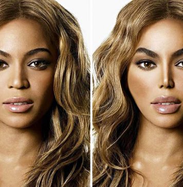 10 Hollywood Celebrities’ Faces Before & After Surgery