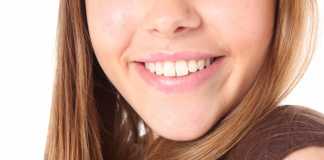 Gleaming Smile, But Be Wary Of How You Whiten Your Teeth