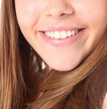 Gleaming Smile, But Be Wary Of How You Whiten Your Teeth
