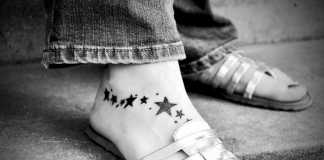 The Advantages of Laser Removal Treatment