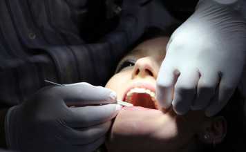 5 Tips for Perfect Teeth