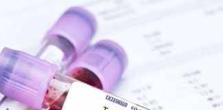 Blood Testing Before Hormone Replacement Therapy