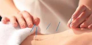 How Acupuncture Can Improve Fertility