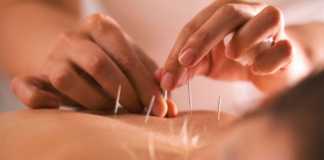 5 Surprising Ways in which Acupuncture Improve Your Looks