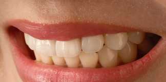 Dental Implants: Basic Overview