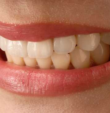 Dental Implants: Basic Overview