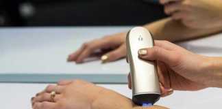 Opté by Procter & Gamble Covers up Pigment Spots Automatically