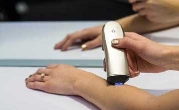 Opté by Procter & Gamble Covers up Pigment Spots Automatically