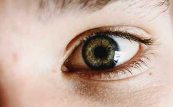 Blepharoplasty Myths & Facts