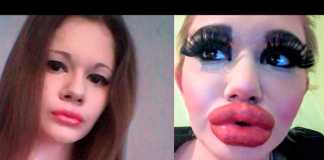 How Does the Woman with the Biggest Lips Look?