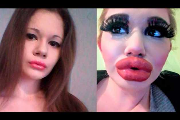 How Does the Woman with the Biggest Lips Look? | Geniusbeauty