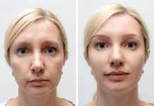 3 New Wonder Ingredients of Anti-Wrinkle Cosmetics