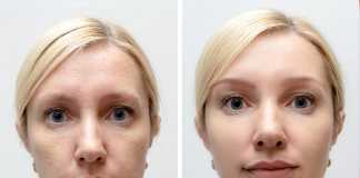 3 New Wonder Ingredients of Anti-Wrinkle Cosmetics