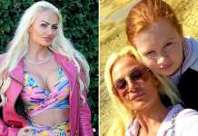 36-Year-Old British Woman Would Choose Another Plastic Surgery over Her Husband