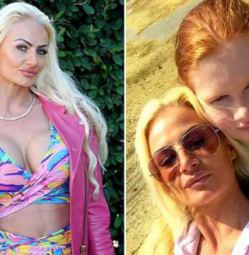 36-Year-Old British Woman Would Choose Another Plastic Surgery over Her Husband