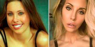 Chloe Lattanzi Accused of Plastic Surgery Addiction