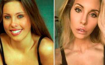 Chloe Lattanzi Accused of Plastic Surgery Addiction