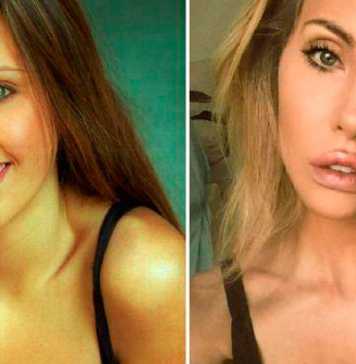 Chloe Lattanzi Accused of Plastic Surgery Addiction