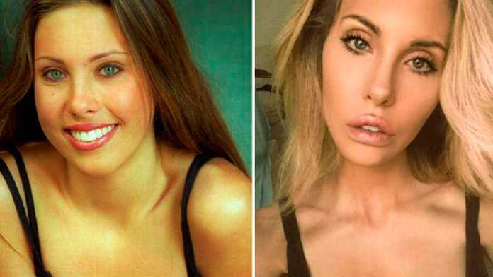 Chloe Lattanzi Accused Of Plastic Surgery Addiction Geniusbeauty 