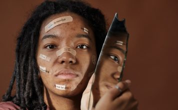4 Unexpected Ways to Treat Acne