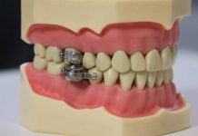 Weirdest Weight Loss Method Ever: DentalSlim Diet Control
