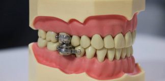 Weirdest Weight Loss Method Ever: DentalSlim Diet Control