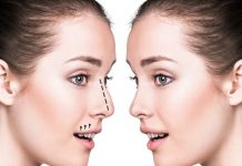 Nose Job Recovery Timeline and Stages of Healing