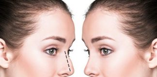 Nose Job Recovery Timeline and Stages of Healing
