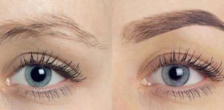 Brow Transplant: Wait, What?