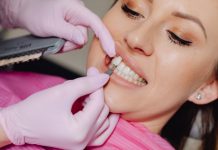 Do You Have to Get Your Teeth Shaved for Veneers?